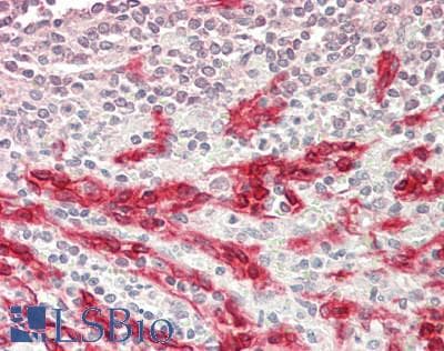 IHC-plus™ Polyclonal Rabbit anti-Human MAPK7 / ERK5 Antibody (aa475-525, IHC)