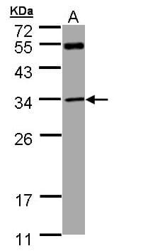 MTAP Antibody (aa1-283)