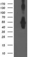CCM2 / Malcavernin Antibody (clone OTI5H4)
