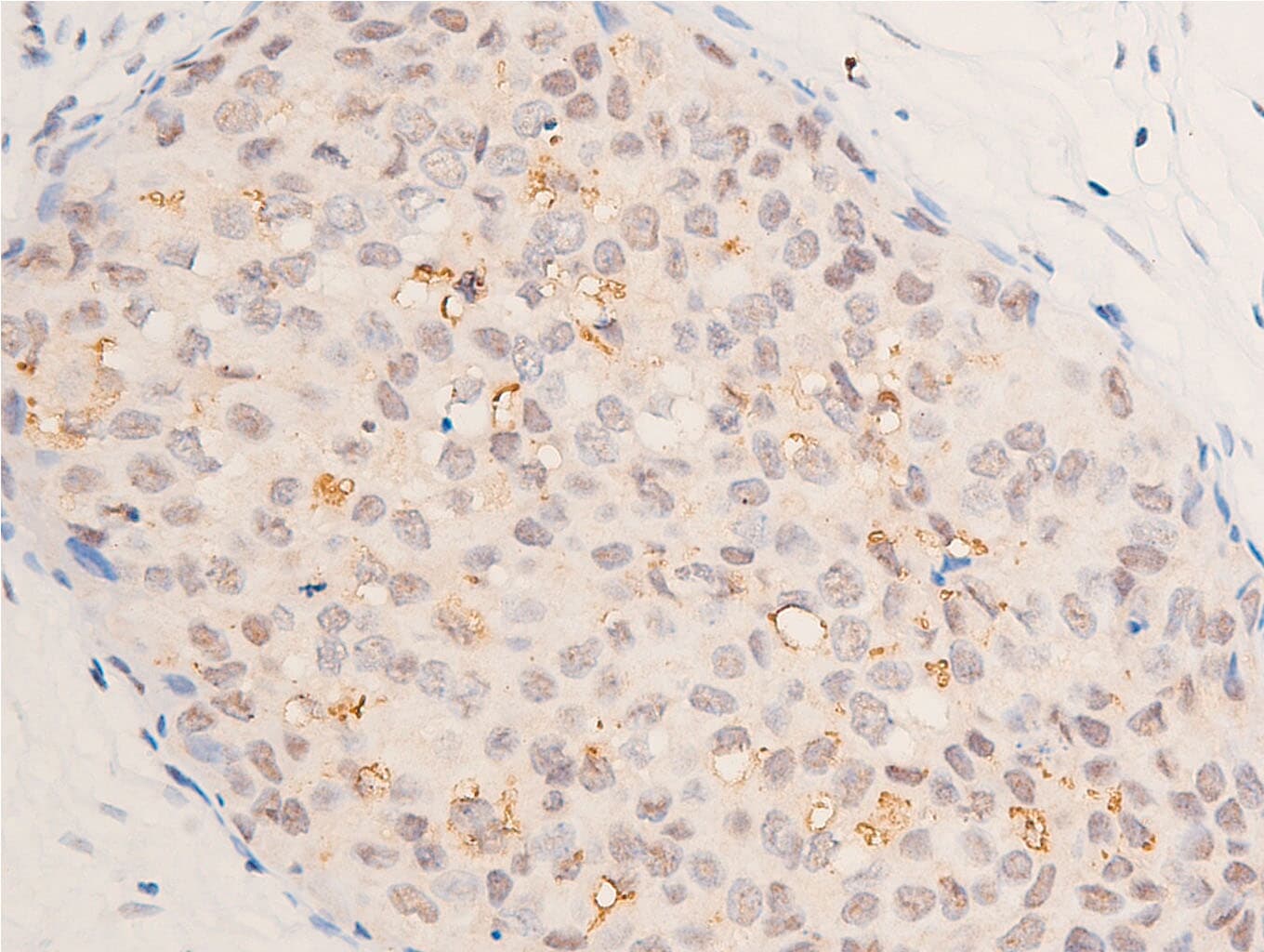 TP53 / p53 Antibody (Acetyl-Lys317)