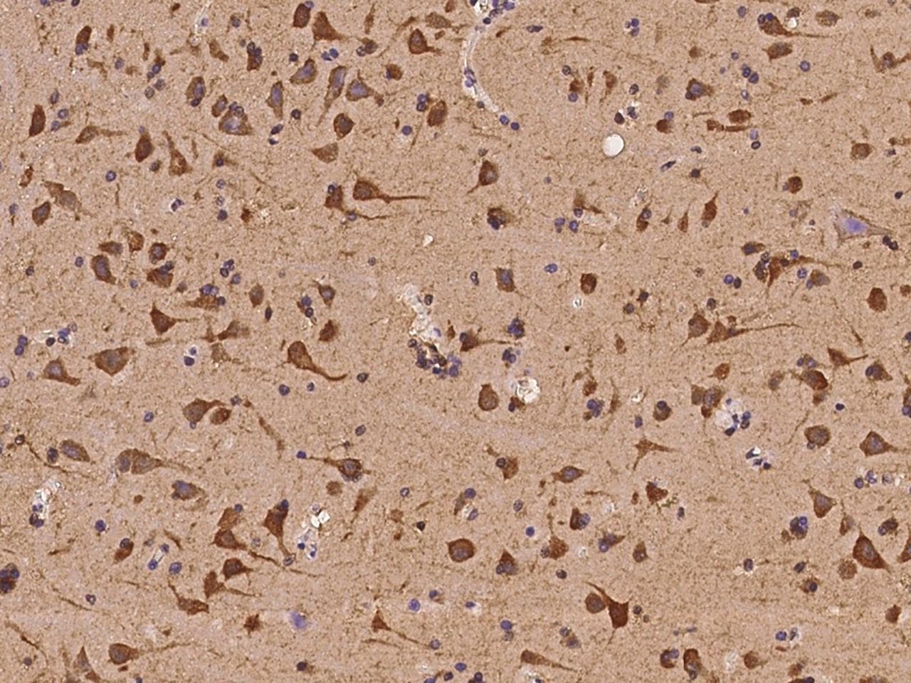 POLR3H Antibody