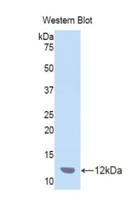 CCL7 / MCP3 Antibody (aa28-97, Cy3)