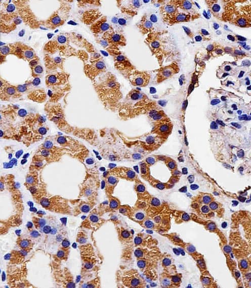 PDCL Antibody (aa1-30)
