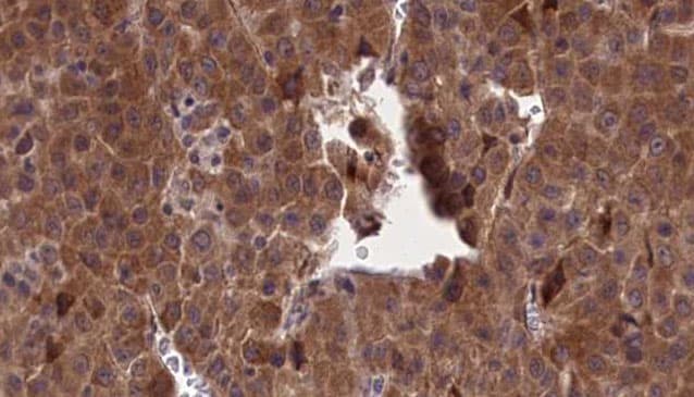 Polyclonal Rabbit anti-Human SELE / CD62E / E-selectin Antibody (IHC, IF, WB)