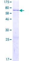 Human ZNF610 Protein (Recombinant GST)