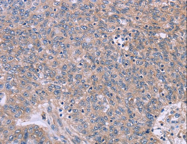 CSF2RB / CD131 Antibody