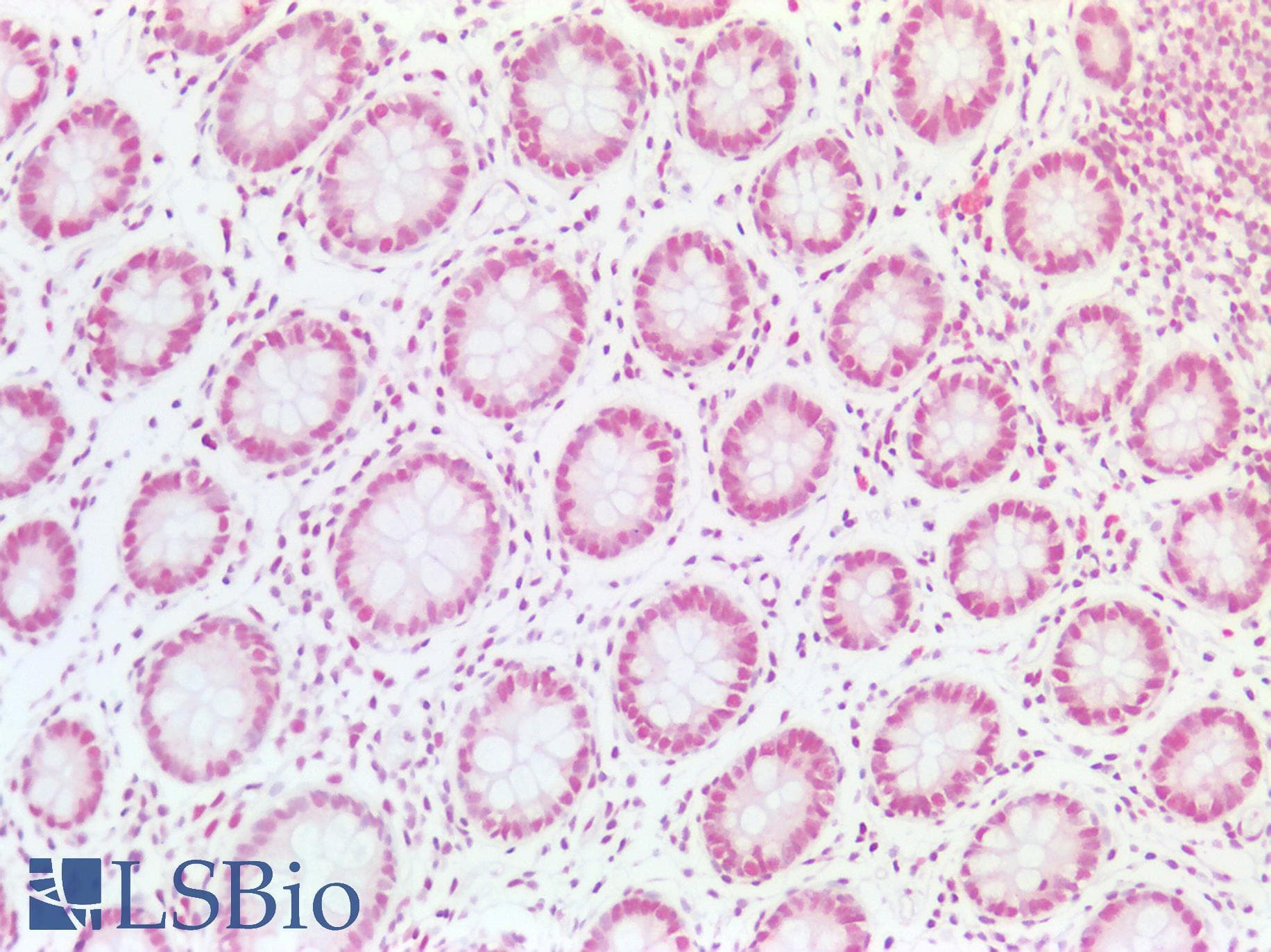 PathPlus™ EP300 / p300 Antibody (aa1-50)