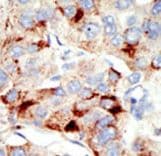 TRDMT1 / DNMT2 Antibody (aa201-230)