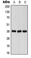 Polyclonal Rabbit anti-Human FPR1 / FPR Antibody (Internal, WB)
