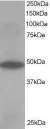 IHC-plus™ OSBPL1A / ORP1 Antibody (aa938-950)