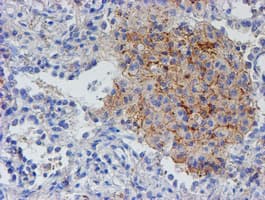 RFXANK Antibody (clone OTI2C6, Carrier-free)