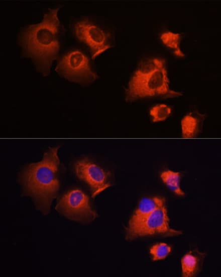 Polyclonal Rabbit anti-Human MCL1 / MCL 1 Antibody (IHC, IF, WB)