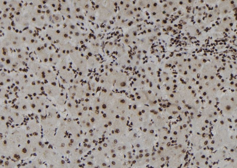 DHX38 Antibody