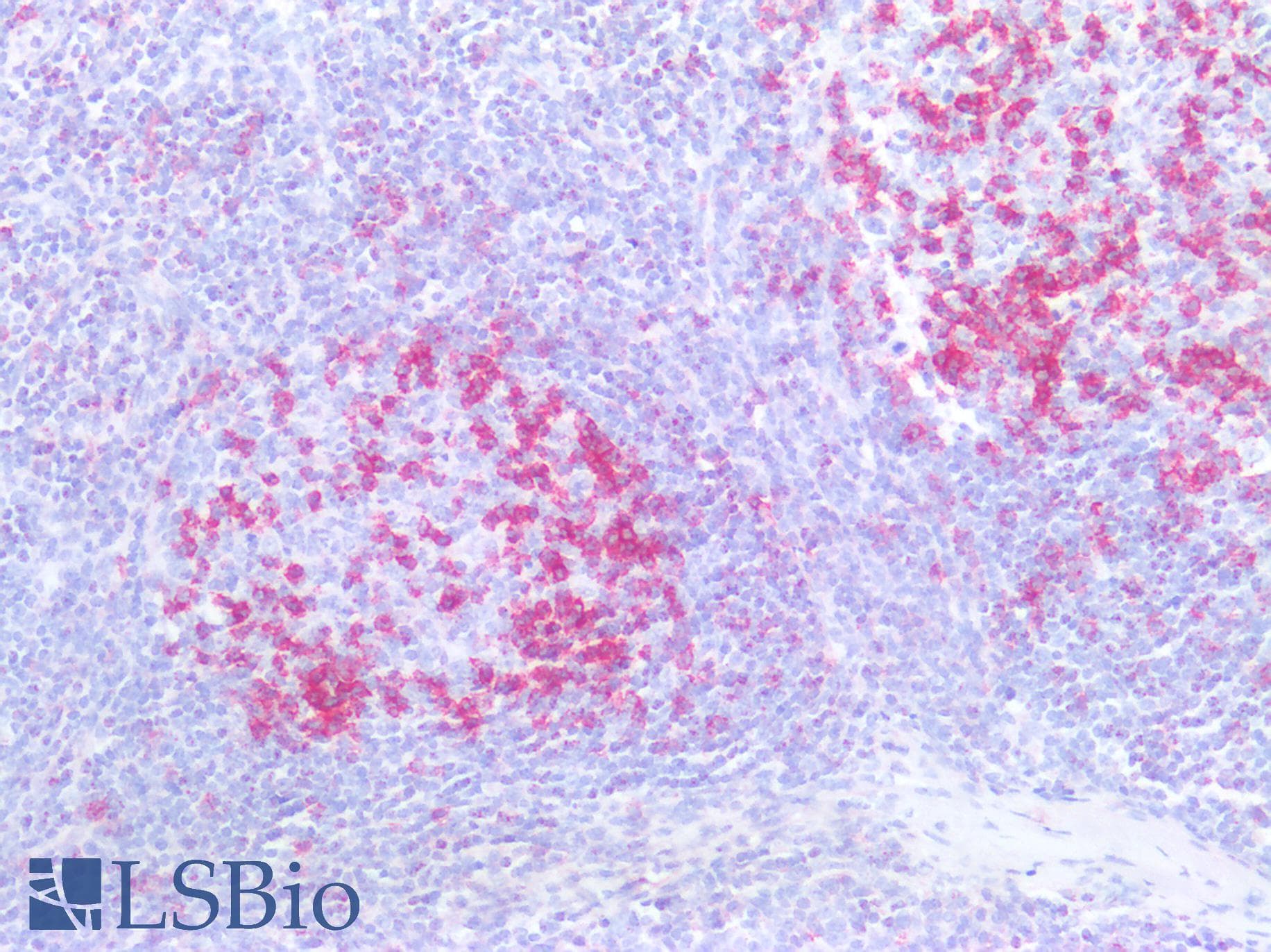 PathPlus™ Monoclonal Mouse anti-Human PDCD1 / CD279 / PD-1 Antibody (clone 5D3, IHC, IF)