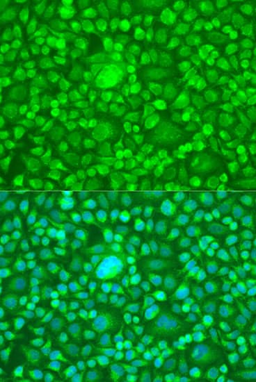 PTEN Antibody