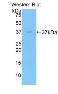 PRAME Antibody (aa416-502)