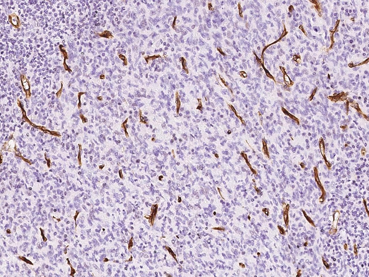 NES / Nestin Antibody (clone 11, Preservative Free)