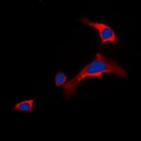 DOK6 Antibody (Internal)