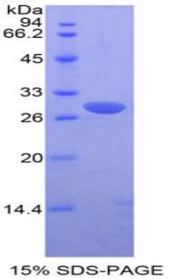 Mouse PIM2 / Pim-2 Protein (Recombinant His-T7)