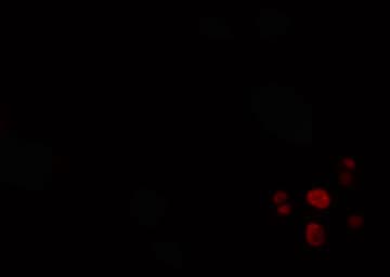 Polyclonal Rabbit anti-Human SRSF4 / SFRS4 Antibody (IF, WB)