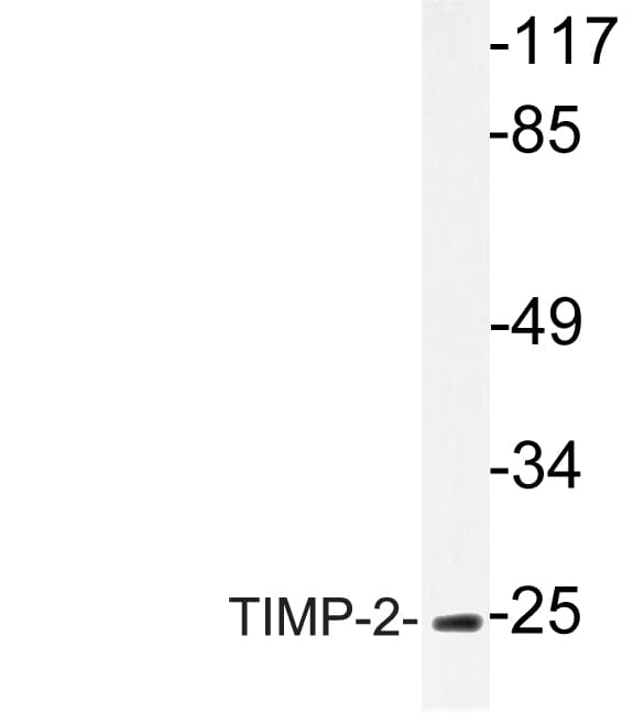 TIMP2 Antibody (Ala47)