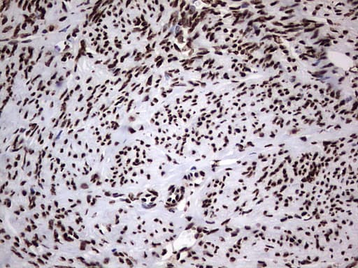 HNRNPL / hnRNP L Antibody (aa270-502, clone OTI9G7, Carrier-free)