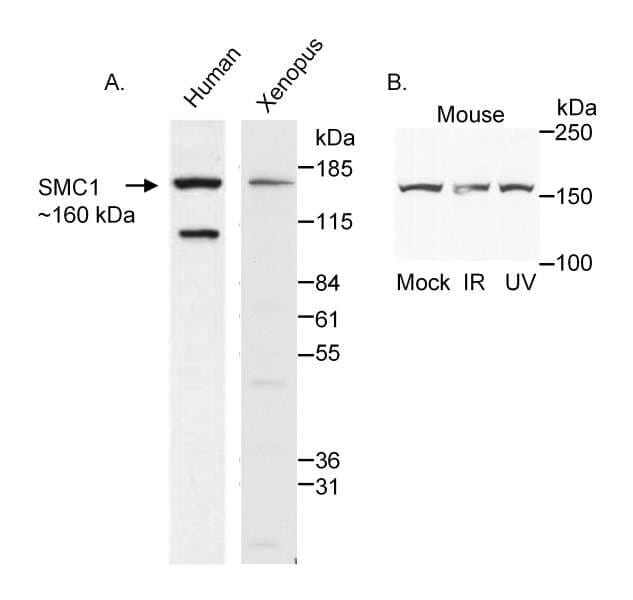 PathPlus™ SMC1A / SMC1 Antibody (aa1175-C-term)
