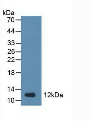 TFF1 / pS2 Antibody (aa1-81)