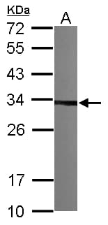 Polyclonal Rabbit anti-Human TBCB / CKAP1 Antibody (aa1-243, IHC, WB)