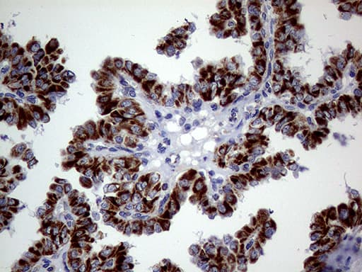 Monoclonal Mouse anti-Human MRPL15 Antibody (clone OTI10B10, aa28-296, IHC, WB)