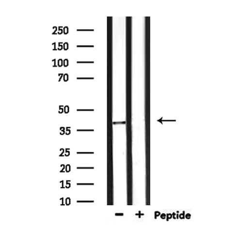 NEUROD4 Antibody