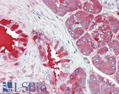 Polyclonal Rabbit anti-Human CPB / Carboxypeptidase B Antibody (aa111-417, IHC, WB)