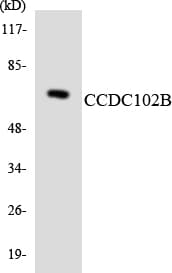 CCDC102B Antibody (aa73-122)