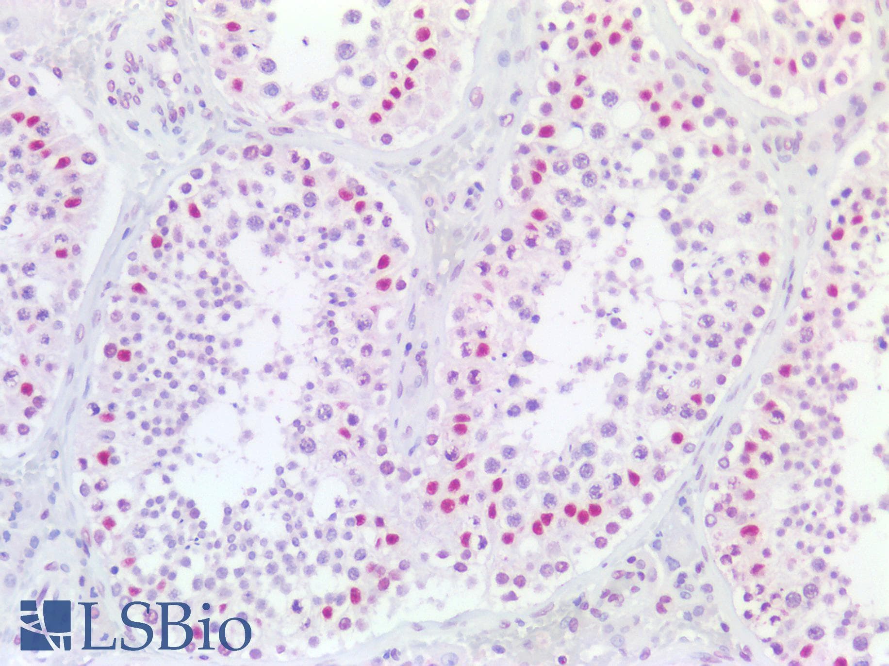 PathPlus™ EP300 / p300 Antibody (aa1572-2371, clone RW128)