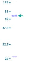 Human CCN3 / NOV Protein (Recombinant GST)