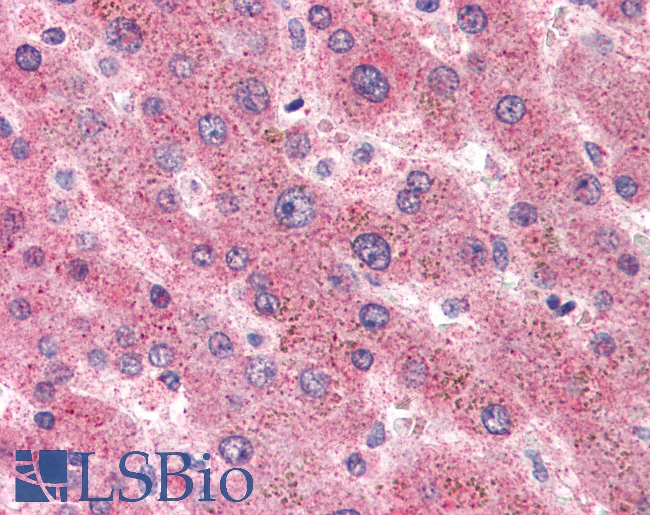 IHC-plus™ SAA1 / SAA / Serum Amyloid A Antibody