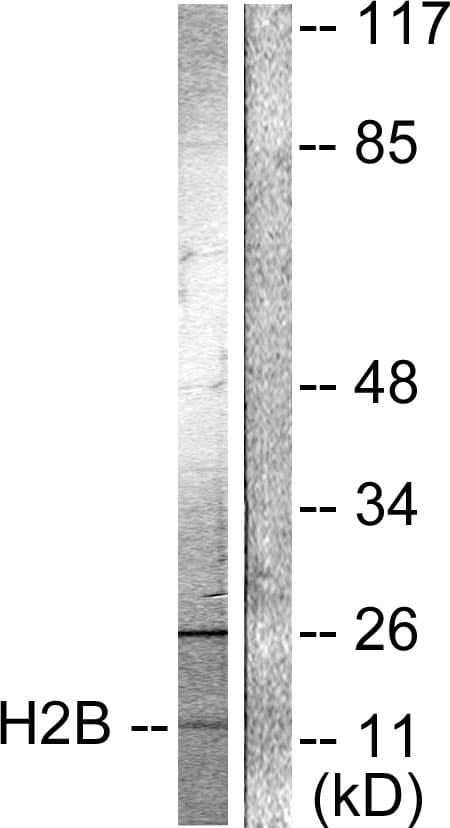 Polyclonal Rabbit anti-Human Histone H2B Antibody (Acetyl-Lys15, IHC, IF, WB)