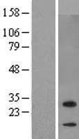 ZBED6CL / C7orf29 Protein (Over-Expression Lysate Myc-DDK (Flag))