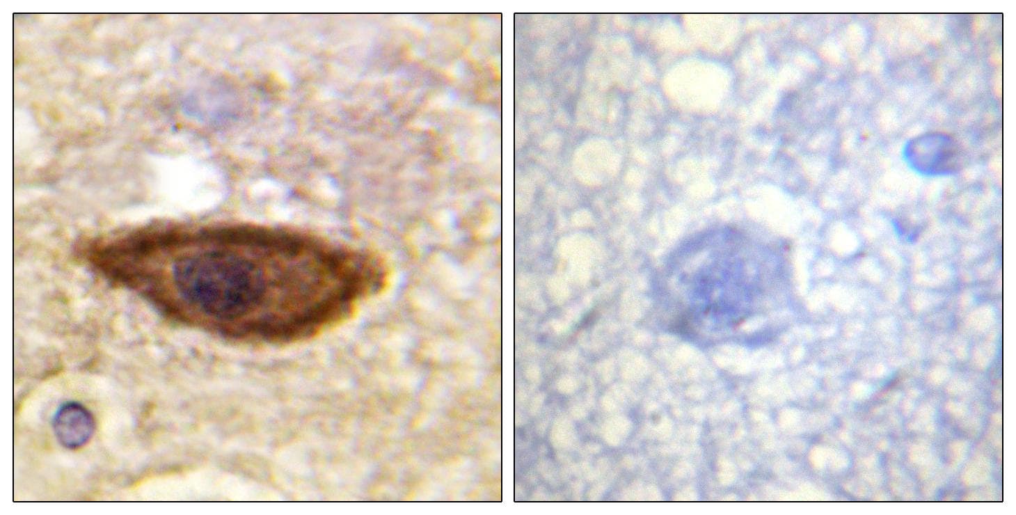 IFNAR1 / IFNAR Antibody