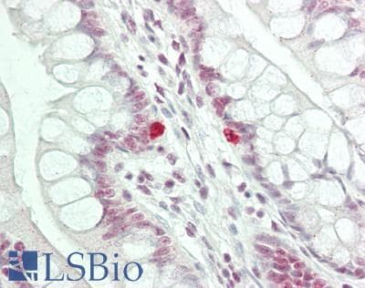 IHC-plus™ PDS5B / AS3 Antibody (aa1200-1250)