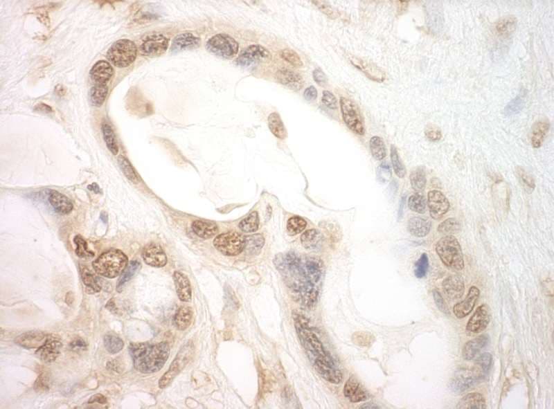 Polyclonal Rabbit anti-Human EIF2B5 Antibody (aa400-450, IHC, WB)