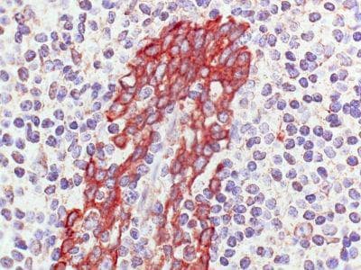 G Protein-Coupled Receptor (MRGF) [Mus musculus] Antibody (clone 1B4)