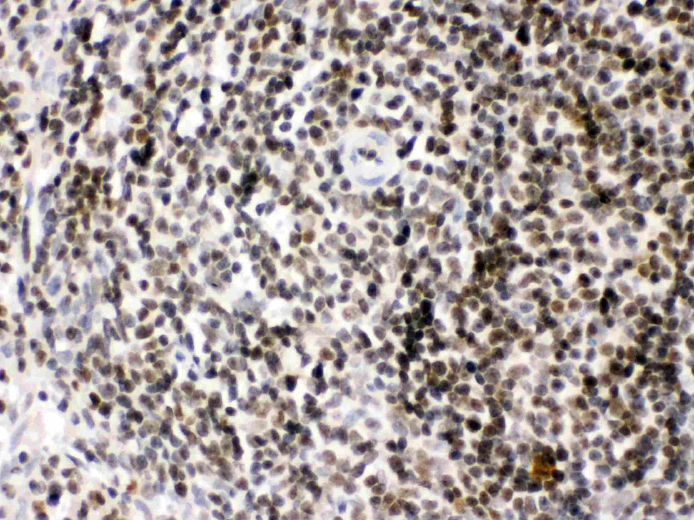 HMG2 / HMGB2 Antibody