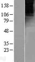 GRM4 / MGLUR4 Protein (Over-Expression Lysate Myc-DDK (Flag))