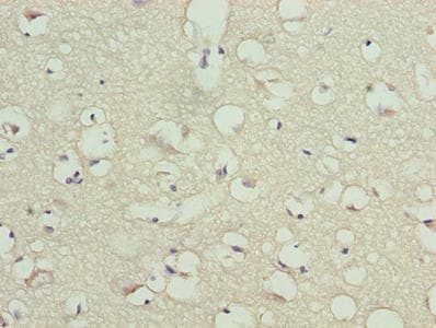 Polyclonal Rabbit anti-Human TMCC1 Antibody (IHC, WB)