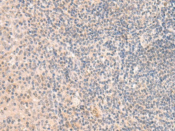 Polyclonal Rabbit anti-Human GRM2 / MGLUR2 Antibody (IHC)