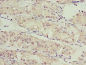 SLC46A1 / HCP1 Antibody