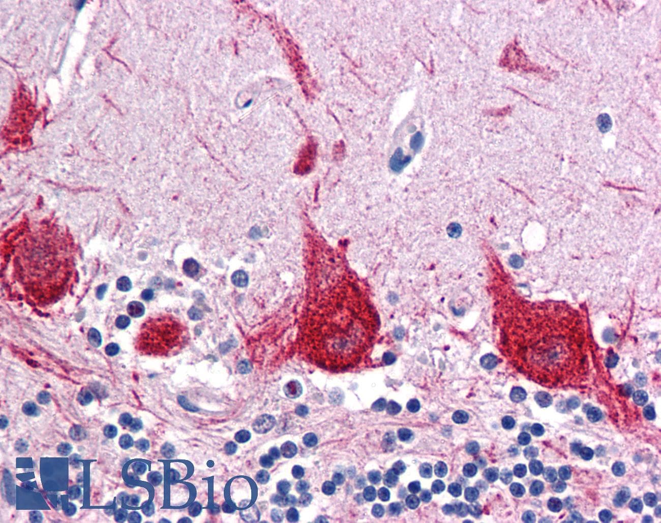 IHC-plus™ BAR / BFAR Antibody