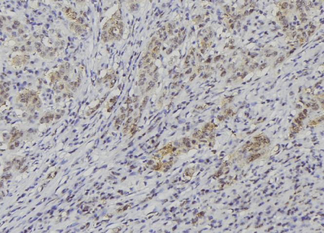 Polyclonal Rabbit anti-Human NBL1 / DAN Antibody (IHC, IF, WB)