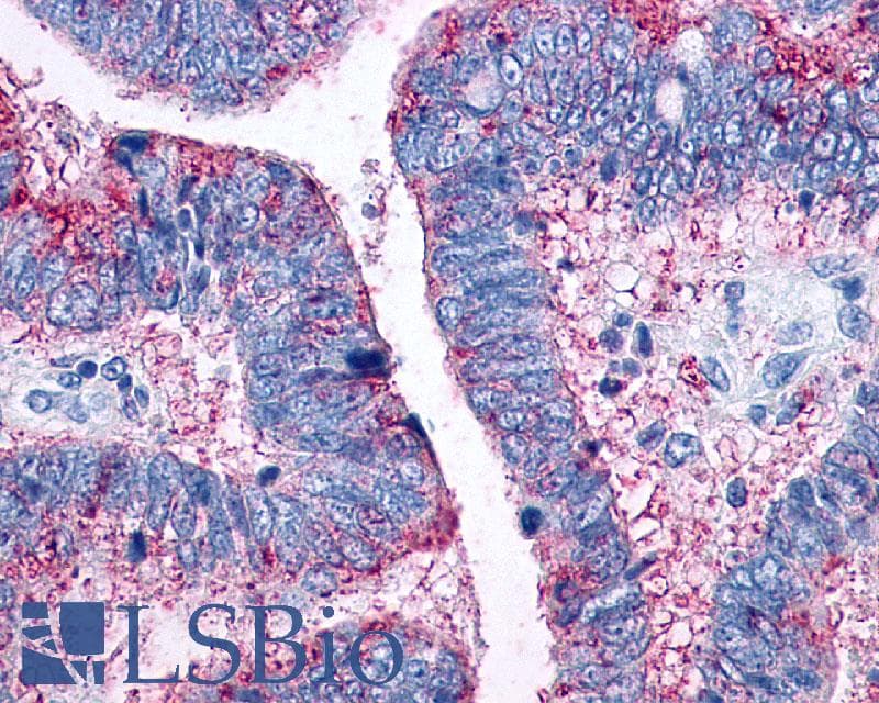 PathPlus™ CCR10 / GPR2 Antibody (Extracellular Domain)